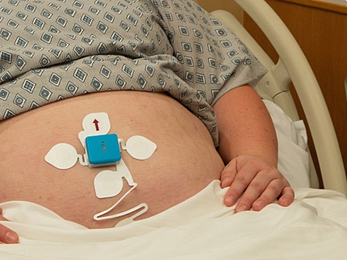 Toco on Baby Monitor A