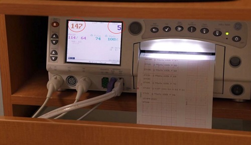 Decoding Toco: What Does Toco Mean on a Baby Monitor?